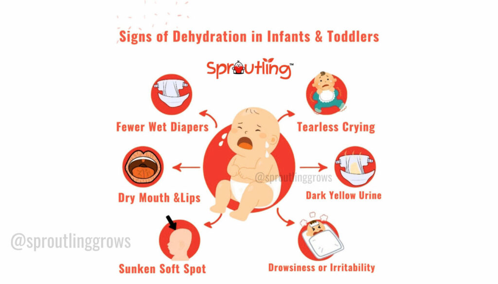 Signs of Dehydration in Infants & Toddlers
